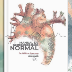 Manual de Electrocardiograma Normal